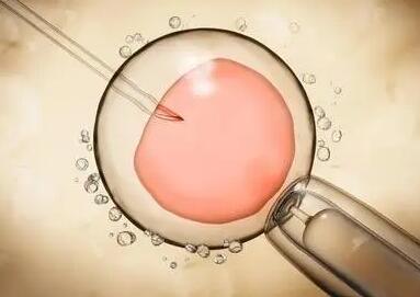 试管婴儿囊胚移植的几率高吗附优势与注意事项